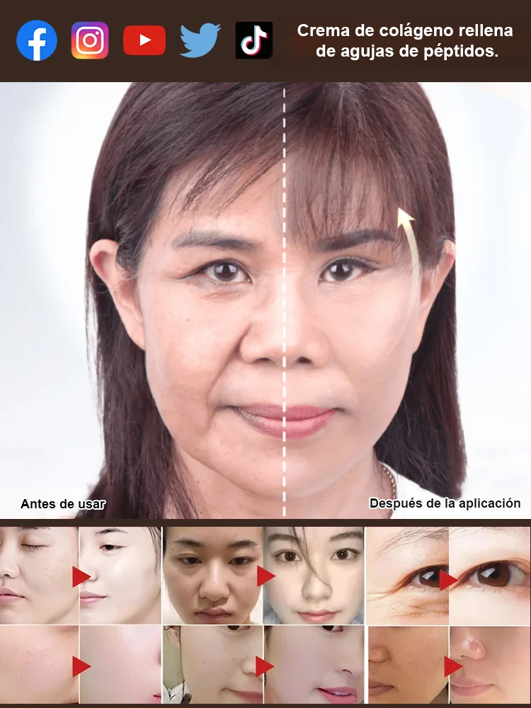 【Arrugas Desvanecidas - Garantía de devolución del 100% si no estás satisfecho】Crema de Colágeno Rellenadora con Péptidos en Jeringa