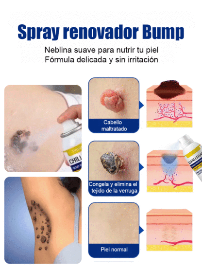 El spray refrescante calmante de hielo✨️Piel pura y suave en 1 semana (100% natural)👍️