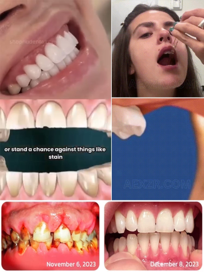 Gotas para el cuidado de la regeneración dental✨️Repara Caries y Protege tus Dientes Naturales