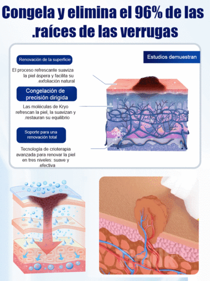 El spray refrescante calmante de hielo✨️Piel pura y suave en 1 semana (100% natural)👍️