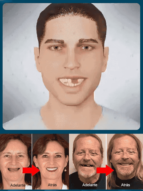 ¡Sonríe con Confianza Otra Vez! Dentadura Personalizada, Médica y Económica