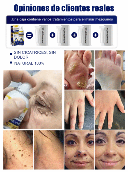 El spray refrescante calmante de hielo✨️Piel pura y suave en 1 semana (100% natural)👍️