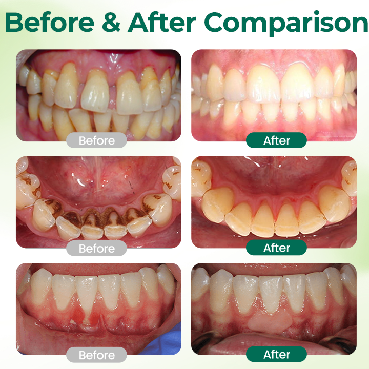 Zero-Waste Mouth Tabs