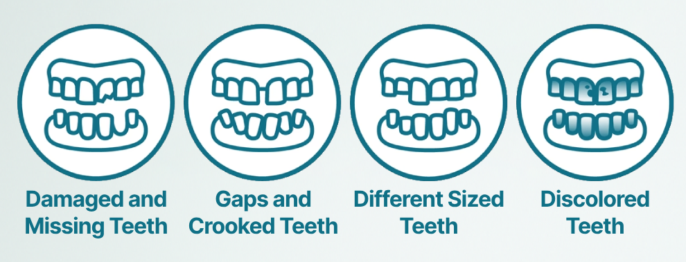 【OFFICIAL STORE】Medazy&trade; Custom-Fit Full Functional Dentures