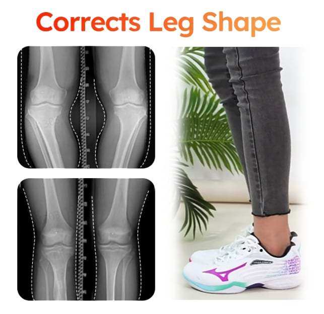 🔥Last day 49% OFF💥Revolutionary Orthopedic Insole