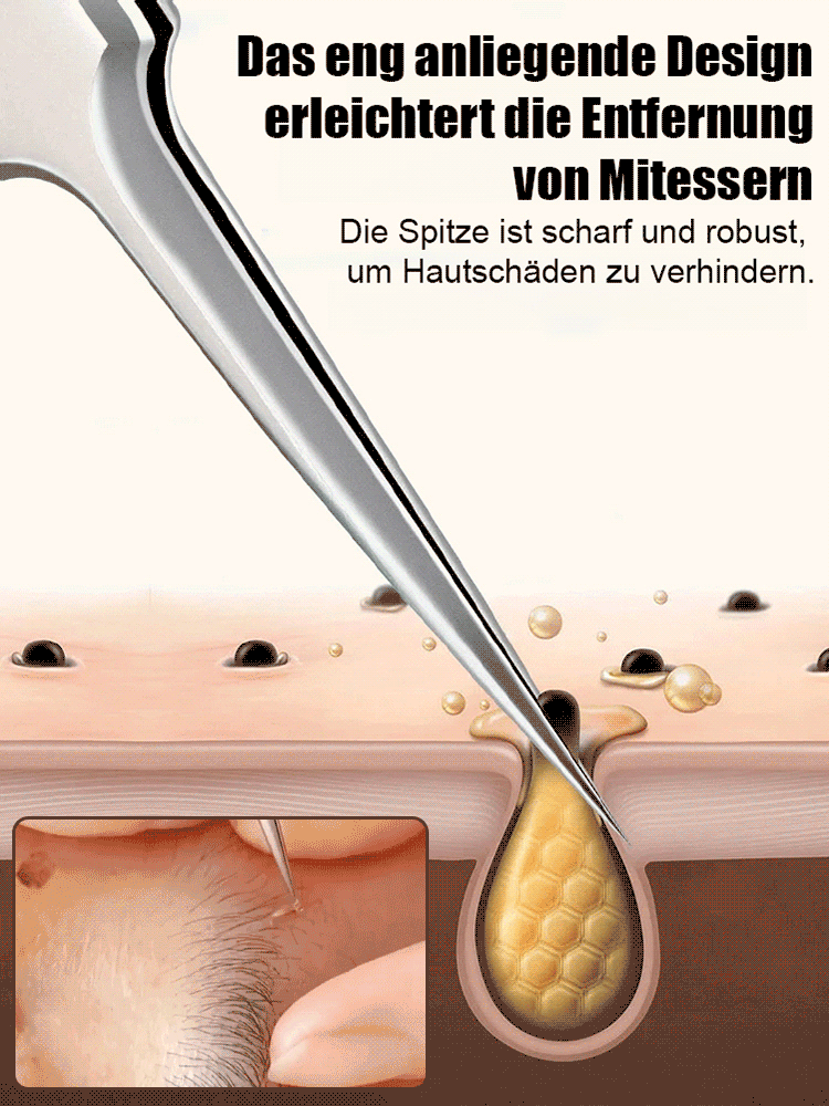 Deutsche Präzisions-Schönheitssalon-Zellklemme