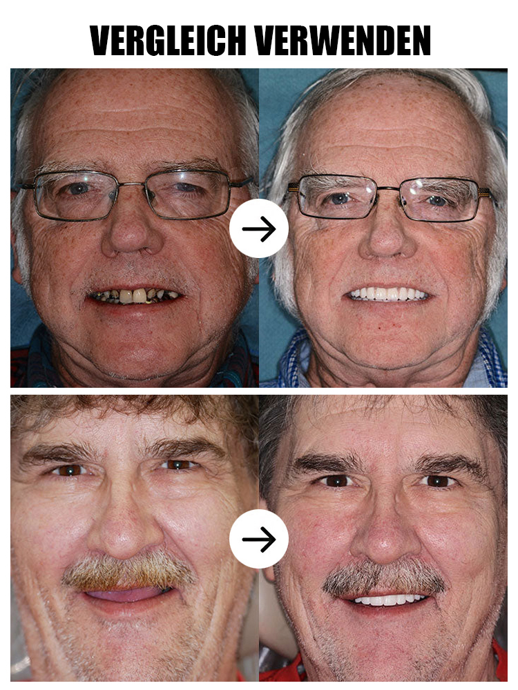 【200.000 Rückkäufe】Zahnkosmetik-Set