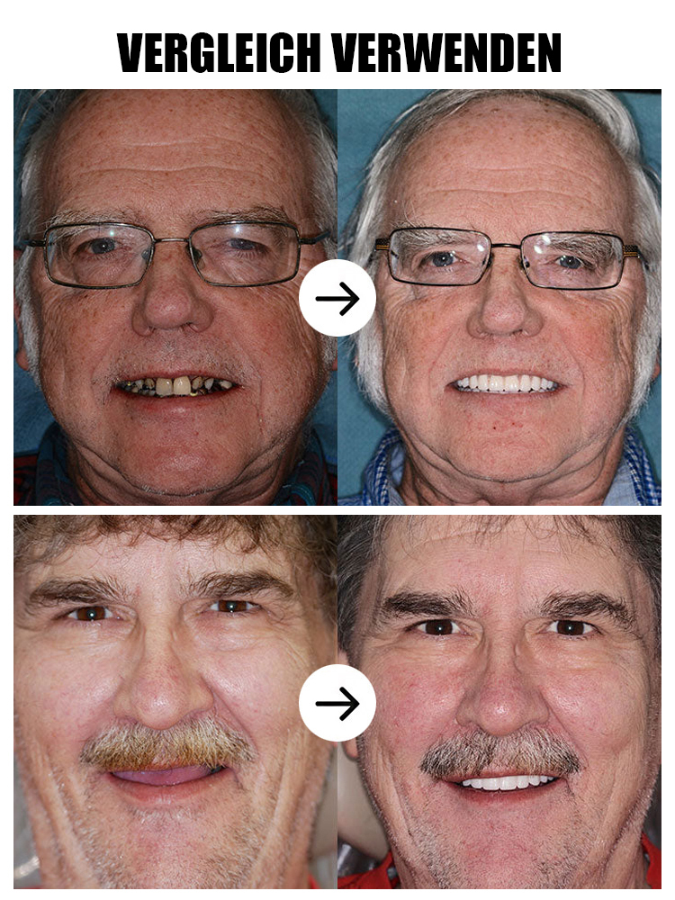 【200.000 Rückkäufe】Zahnkosmetik-Set