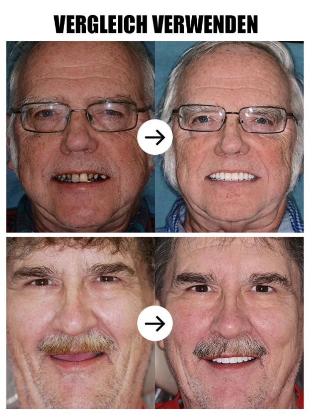 【200.000 Rückkäufe】Zahnkosmetik-Set