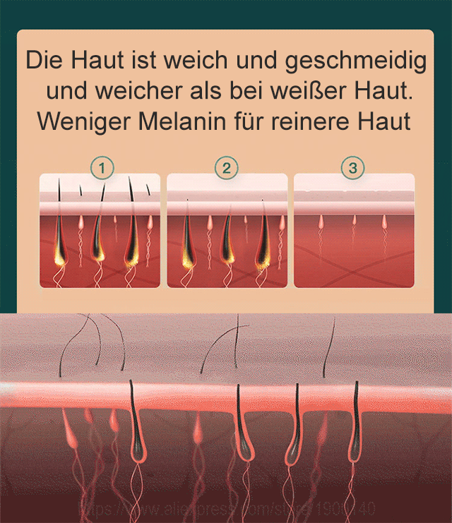 NOOD Intense Pulsed Home Laser Haarentfernungsgerät