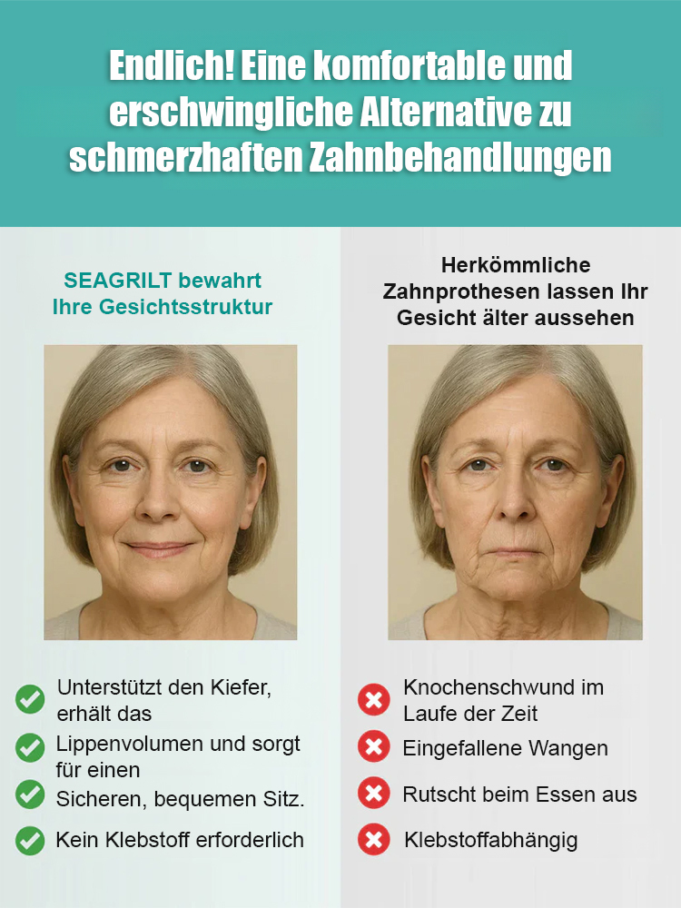 [Perfektes Lächeln in 1 Sekunde] Unsichtbare Silikon-Veneers – Täuschend echt