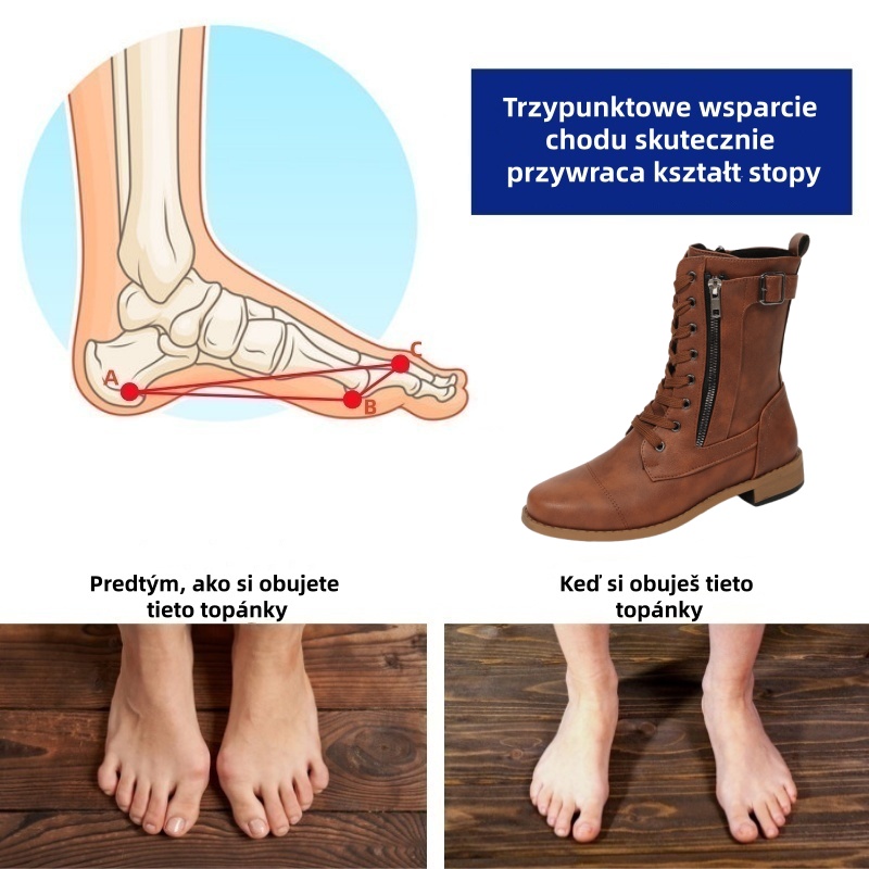 🔥Dziś połowa ceny - Nie przegap ⏰ Ergonomicznie zaprojektowane buty ortopedyczne - Wysokiej jakości skóra 👞Ręcznie szyte buty damskie
