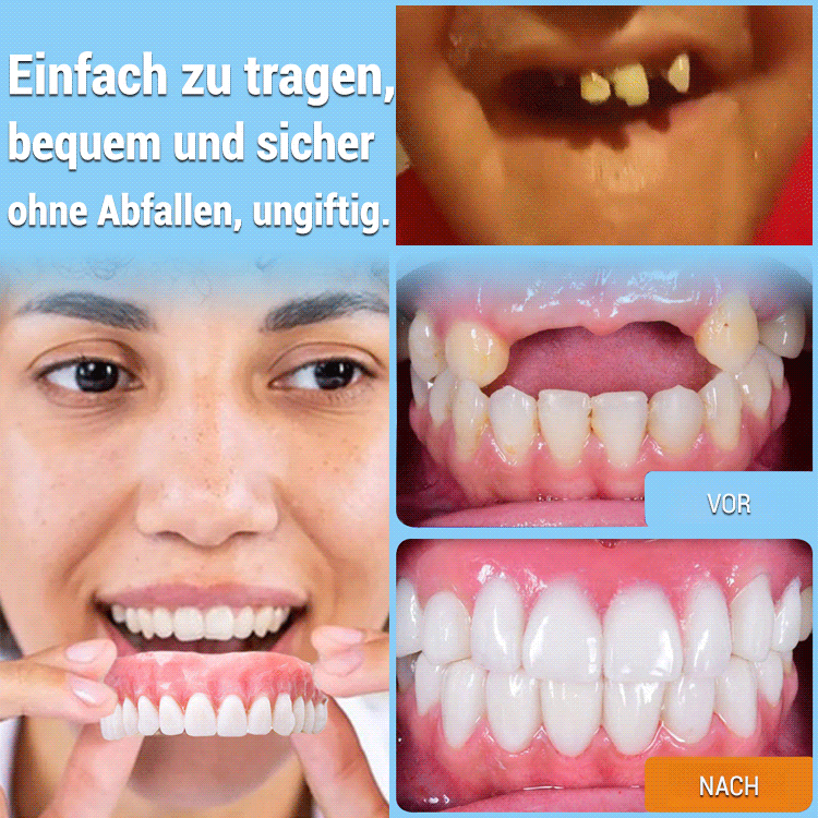 【Hergestellt in den USA, FDA-zertifiziert】Individuell angepasstes Komplett-Zahnprothesen-Set