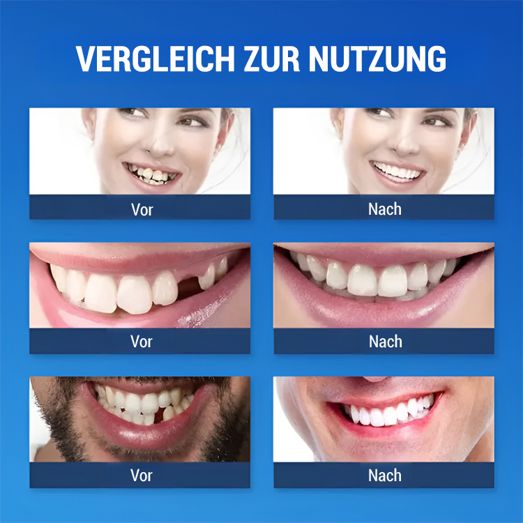 【Hergestellt in den USA, FDA-zertifiziert】Individuell angepasstes Komplett-Zahnprothesen-Set