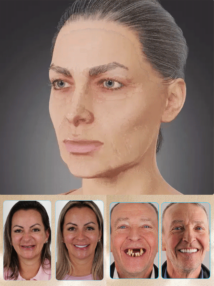 【Selling Out Across North American Dentistry!】TrueEase™ Custom Invisible Dentures for Missing Teeth