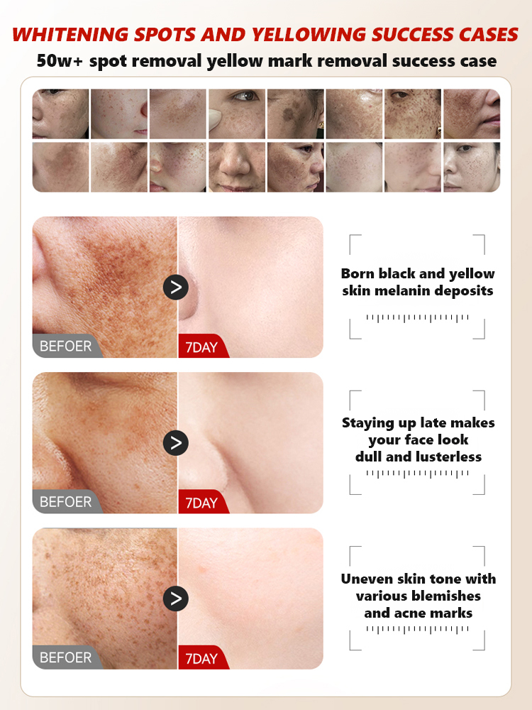 【3 in 1】Whitening, Anti-Blemish and Anti-Wrinkle Essence