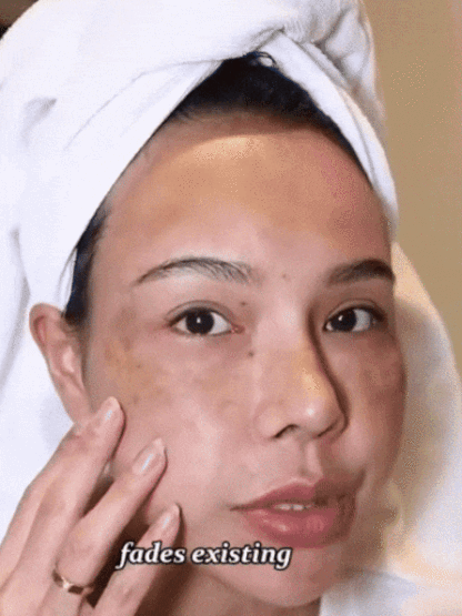 【3 in 1】Whitening, Anti-Blemish and Anti-Wrinkle Essence