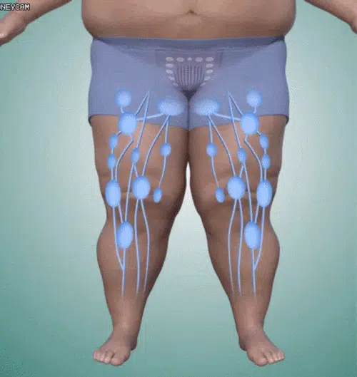 5dccd6a82f669b772d22a94d89633a50.webp