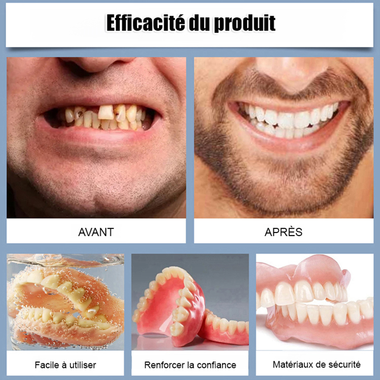 【Tout compris sur mesure】Kit de soin et de retouche pour prothèses dentaires