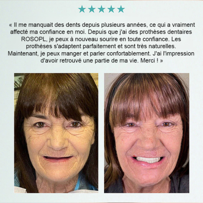 【Tout compris sur mesure】Kit de soin et de retouche pour prothèses dentaires