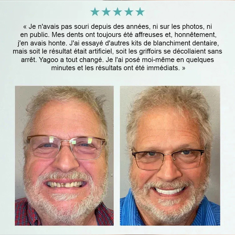 【Tout compris sur mesure】Kit de soin et de retouche pour prothèses dentaires