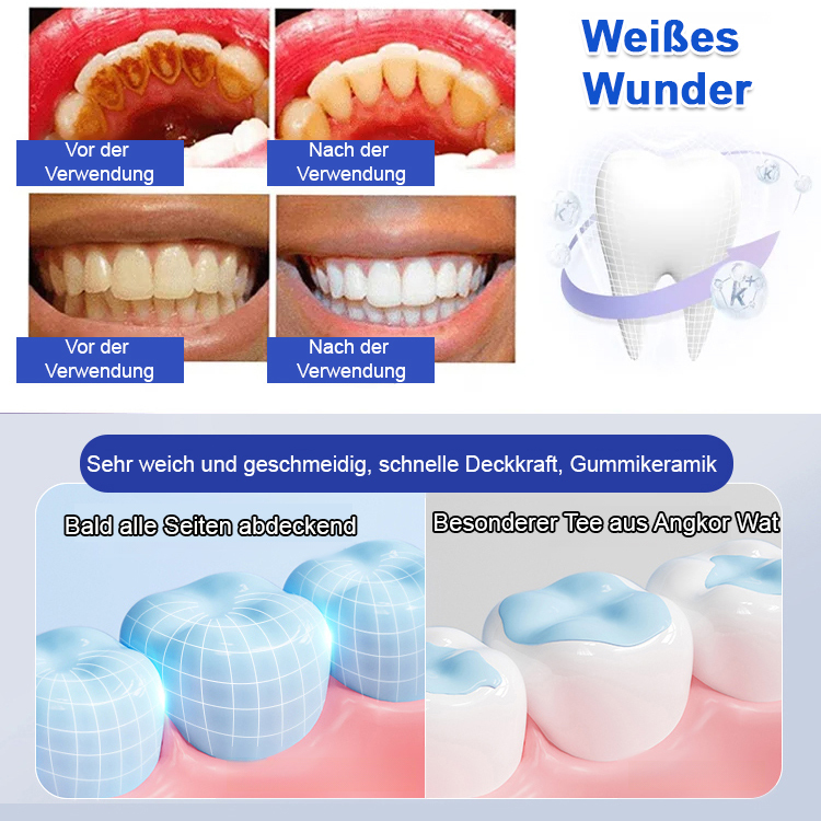 7,5% Nano-Hydroxyapatit Reparaturzahnpasta