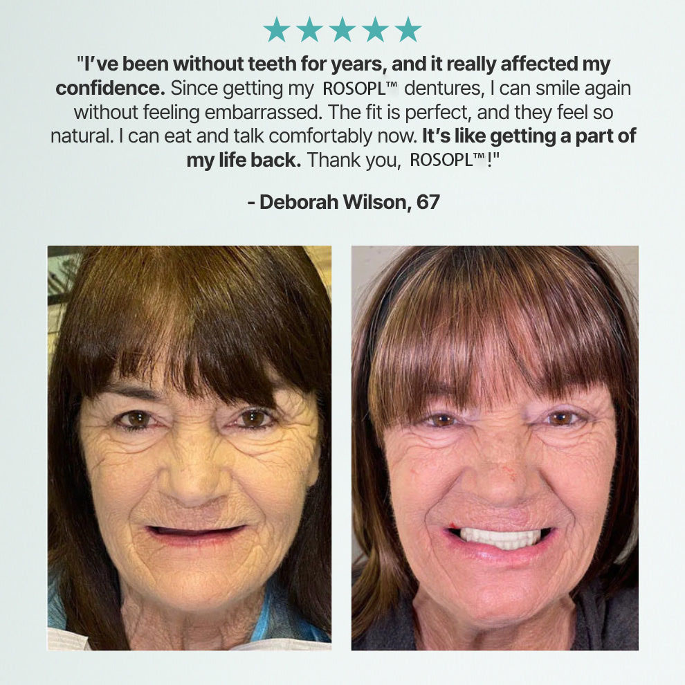 ✨Ends Today: 70% OFF! ROSOPLTM Custom-Fit Full Functional DenturesMake you more confident