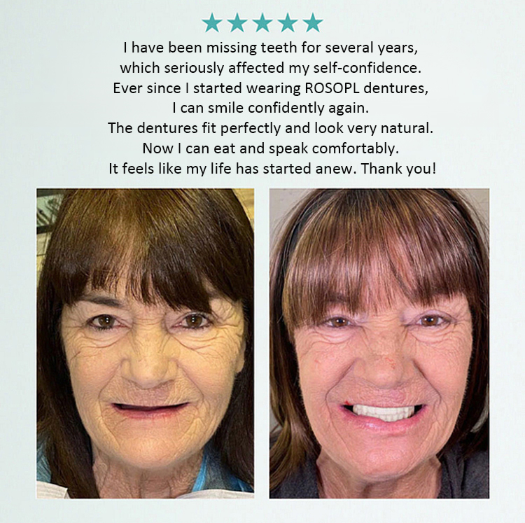 【🛑 Stop paying thousands fordental implants! Get a flawless Hollywood smile in just 1 second with a simple "snap". Crafted with patented F-class adaptive silicone—ZERO glue or adhesives required!】