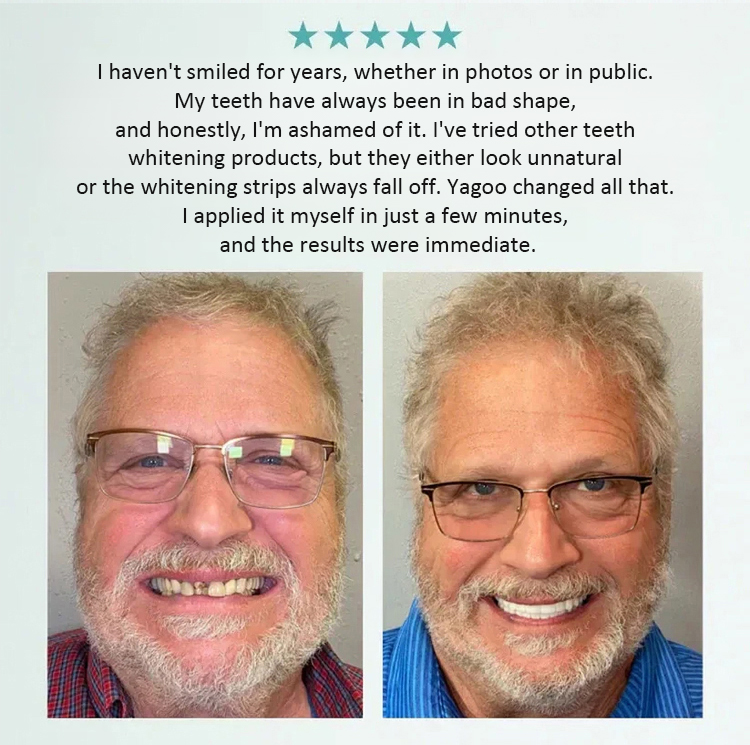【🛑 Stop paying thousands fordental implants! Get a flawless Hollywood smile in just 1 second with a simple "snap". Crafted with patented F-class adaptive silicone—ZERO glue or adhesives required!】