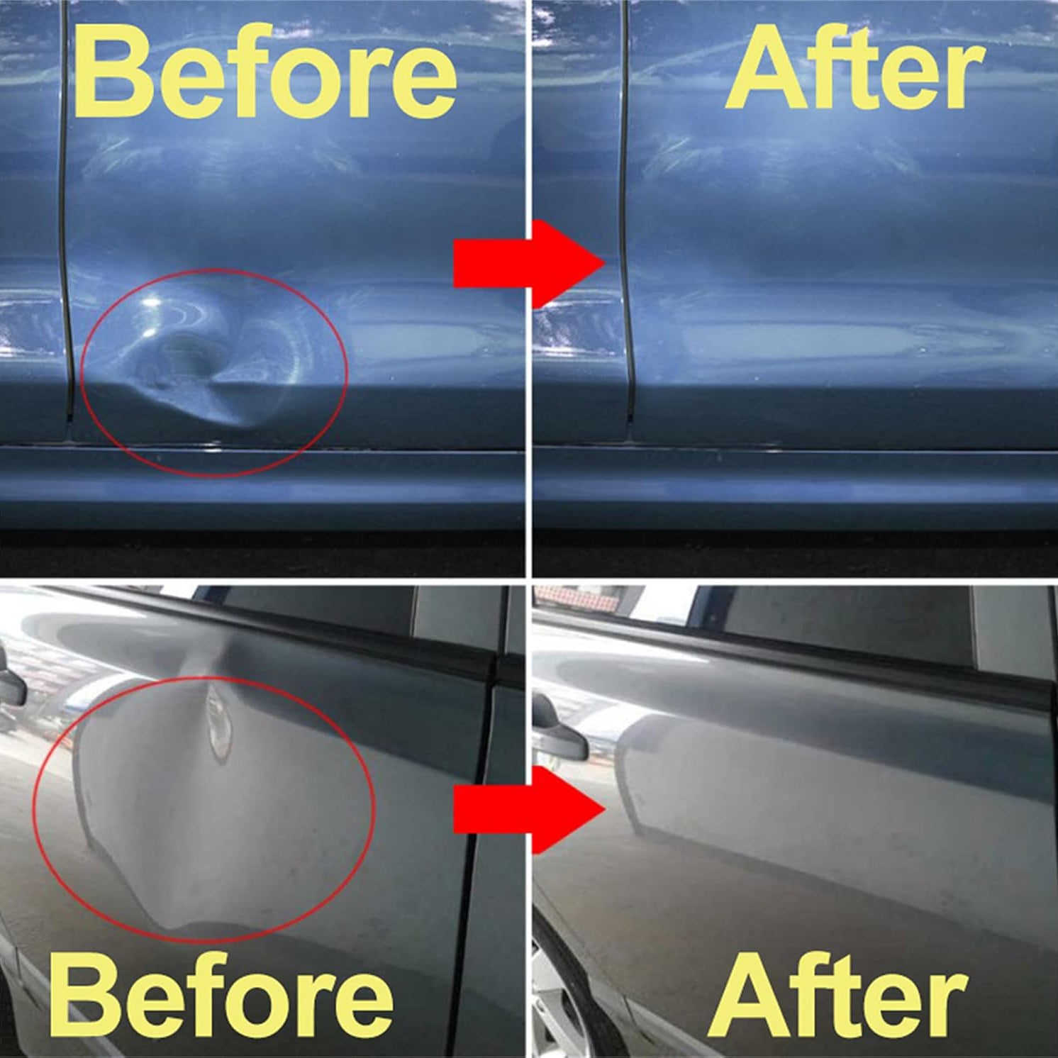 Car Dent Repair Kit – Paintless Dent Removal Tool for Automotive Body Repair