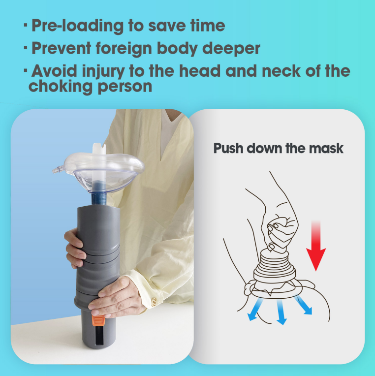 Automatic Anti-Choking Rescue Device for Kids & Adults