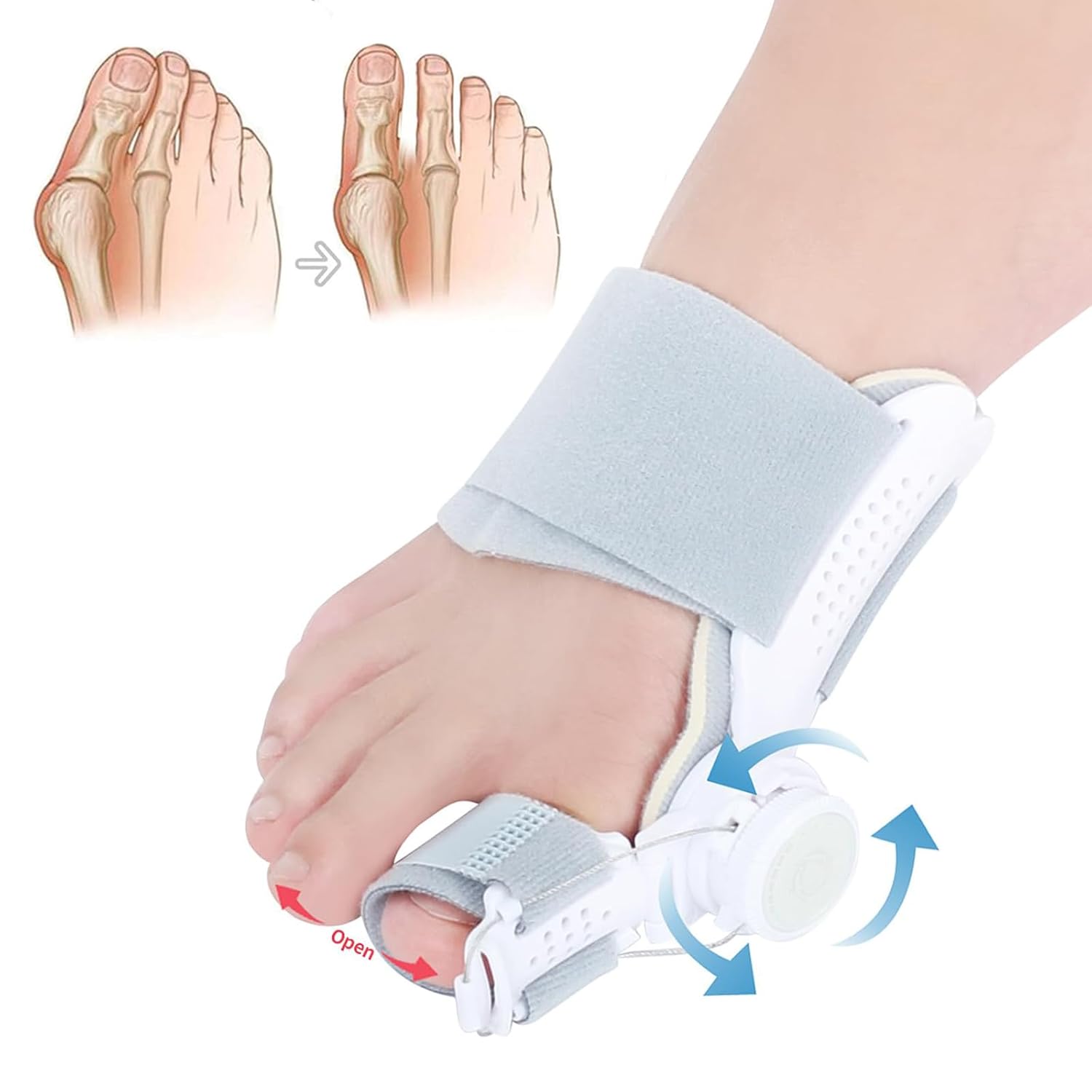 Fix Hallux Valgus Fast – Adjustable Toe Straightener for Instant Relief & Natural Correction！