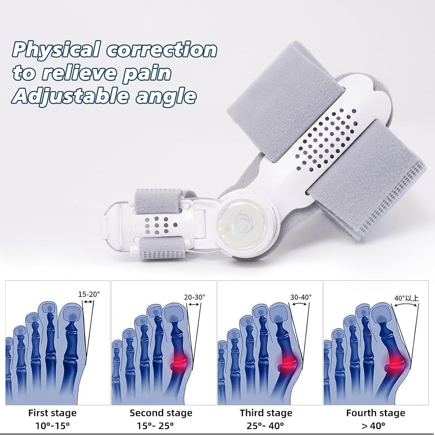 Fix Hallux Valgus Fast – Adjustable Toe Straightener for Instant Relief & Natural Correction！