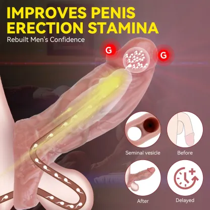 Dorus 6.5“x2.2” Fat Flesh Skin Realistic Cock Extender Sleeve