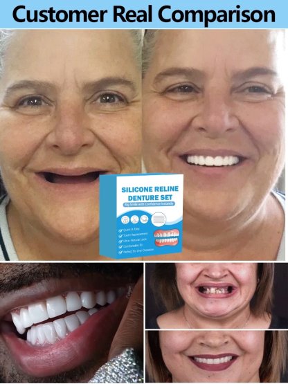 【Made in USA, FDA Approved】Custom Full Mouth Dentures Kit
