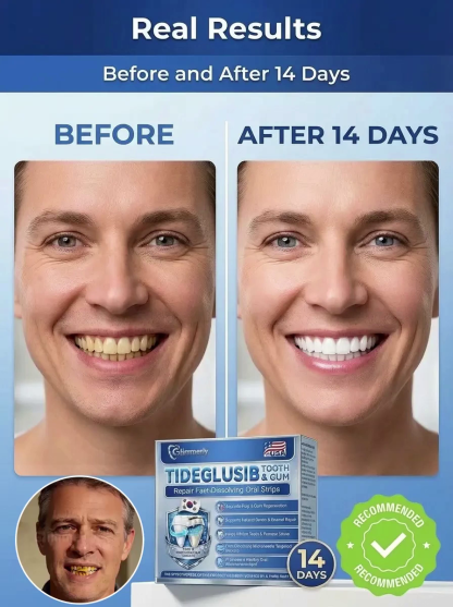 【Buy one get one free for a limited time!】Instant Dental & Gum Repair Oral Patch【Highly recommended by dentists.】