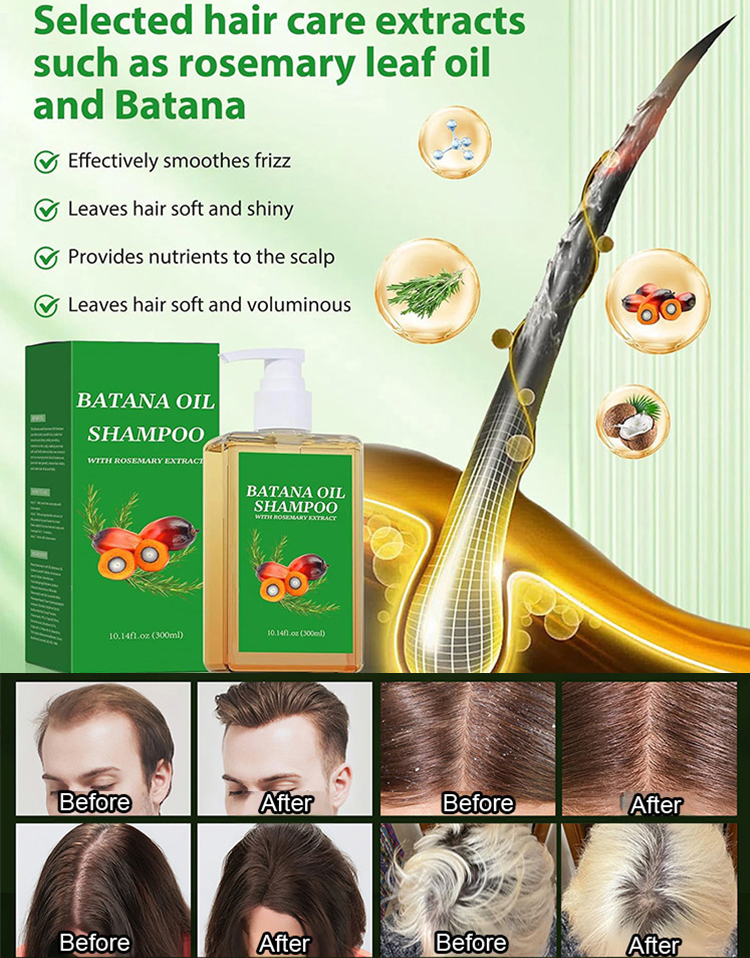 Activate your hair follicles and stimulate the growth of new hair, making it thicker and denser, as if you were returning to your youthful years in your twenties.