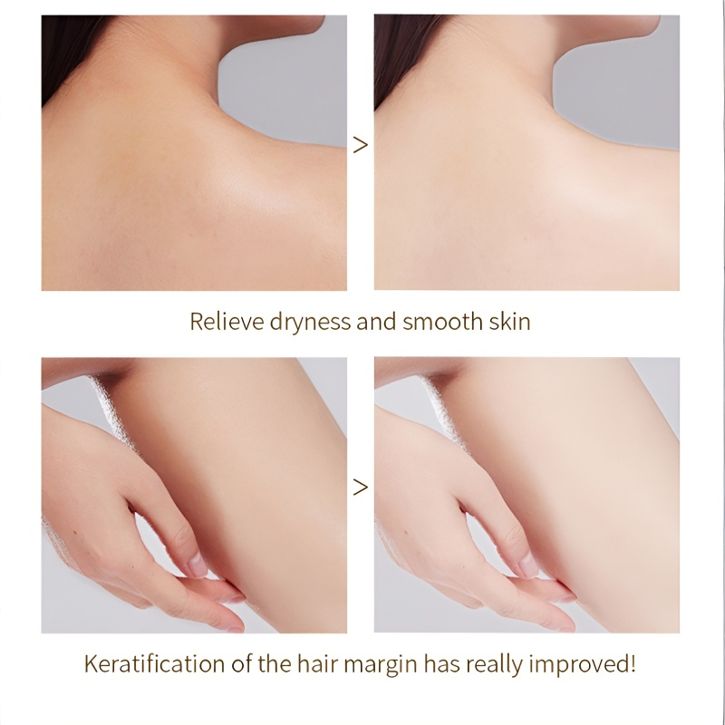 💖Simply apply and your skin will become snow-white in 3 seconds.