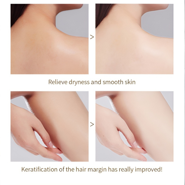 💖Simply apply and your skin will become snow-white in 3 seconds.