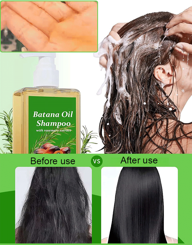 Activate your hair follicles and stimulate the growth of new hair, making it thicker and denser, as if you were returning to your youthful years in your twenties.