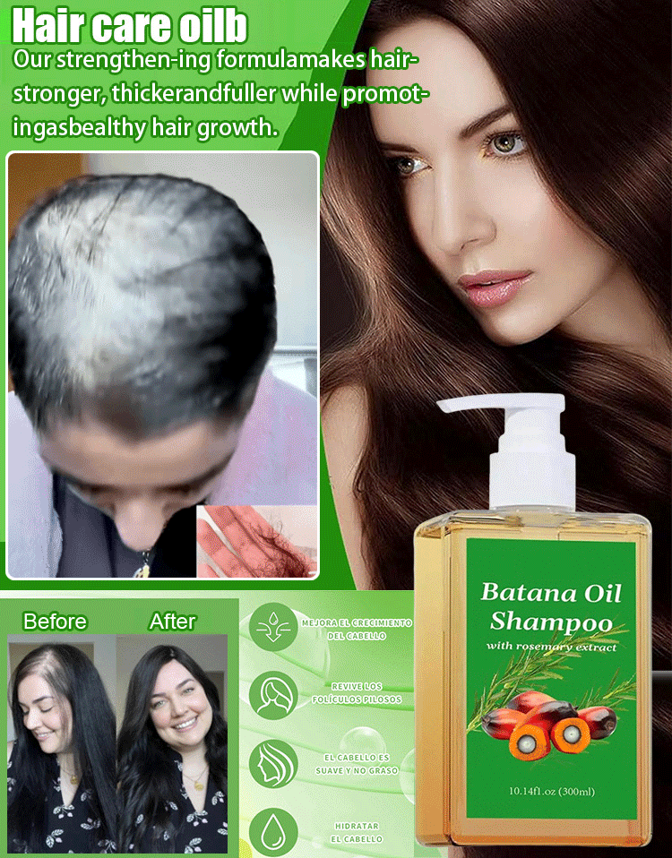 Activate your hair follicles and stimulate the growth of new hair, making it thicker and denser, as if you were returning to your youthful years in your twenties.