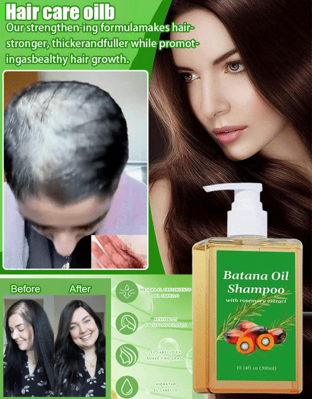 Activate your hair follicles and stimulate the growth of new hair, making it thicker and denser, as if you were returning to your youthful years in your twenties.