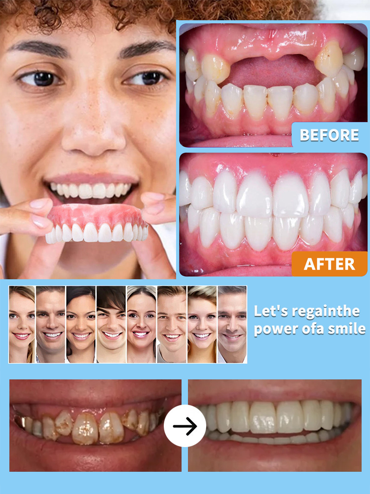 【200,000 Repurchases】🔬🏥 Better‑than‑implant solution – 30 years of research for a flawless, secure fit.