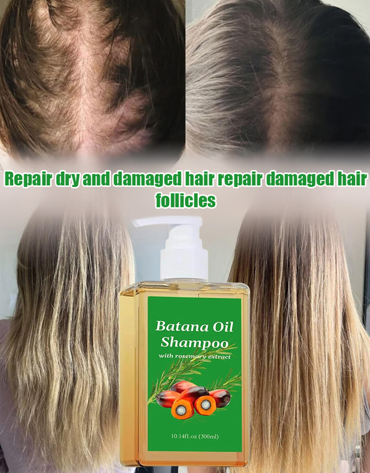 Activate your hair follicles and stimulate the growth of new hair, making it thicker and denser, as if you were returning to your youthful years in your twenties.
