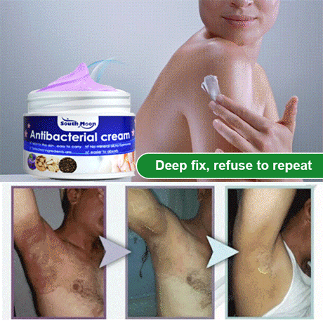 South Moon Viola Philippica Itchy Skin Repair Cream