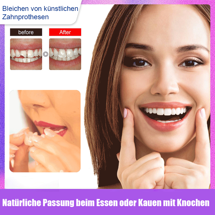 Zahnaufhellung Simulation falsche Zahnspangen