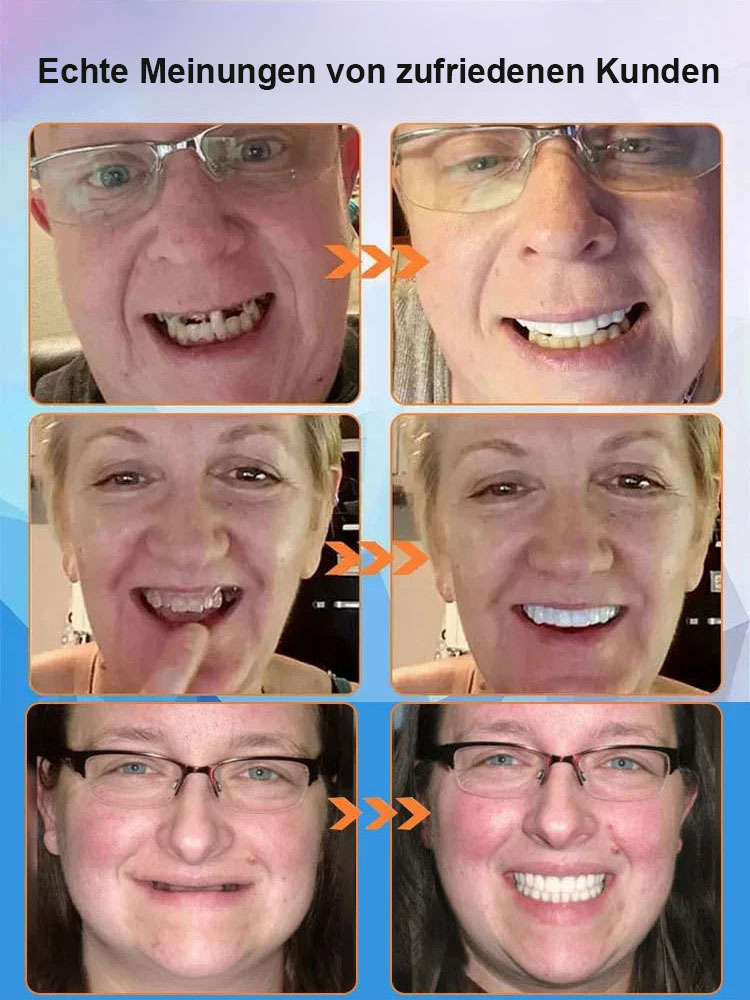 【Neue Forschungsergebnisse aus Großbritannien】Silikon-ähnliche Zahnprothesen