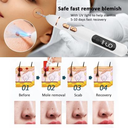 Mole and skin growth removal pen