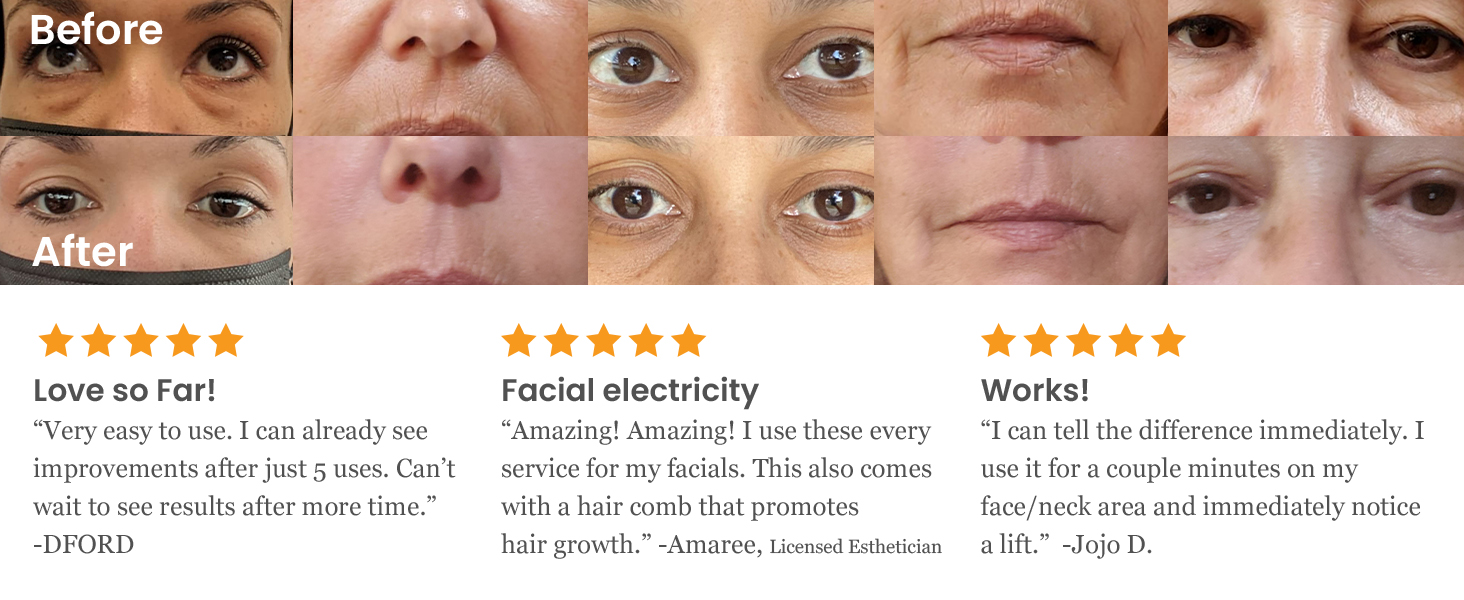 scscNuDerma Portable Handheld High Frequency Skin Therapy Wand Machine w/Neon &ndash; Anti-Aging 