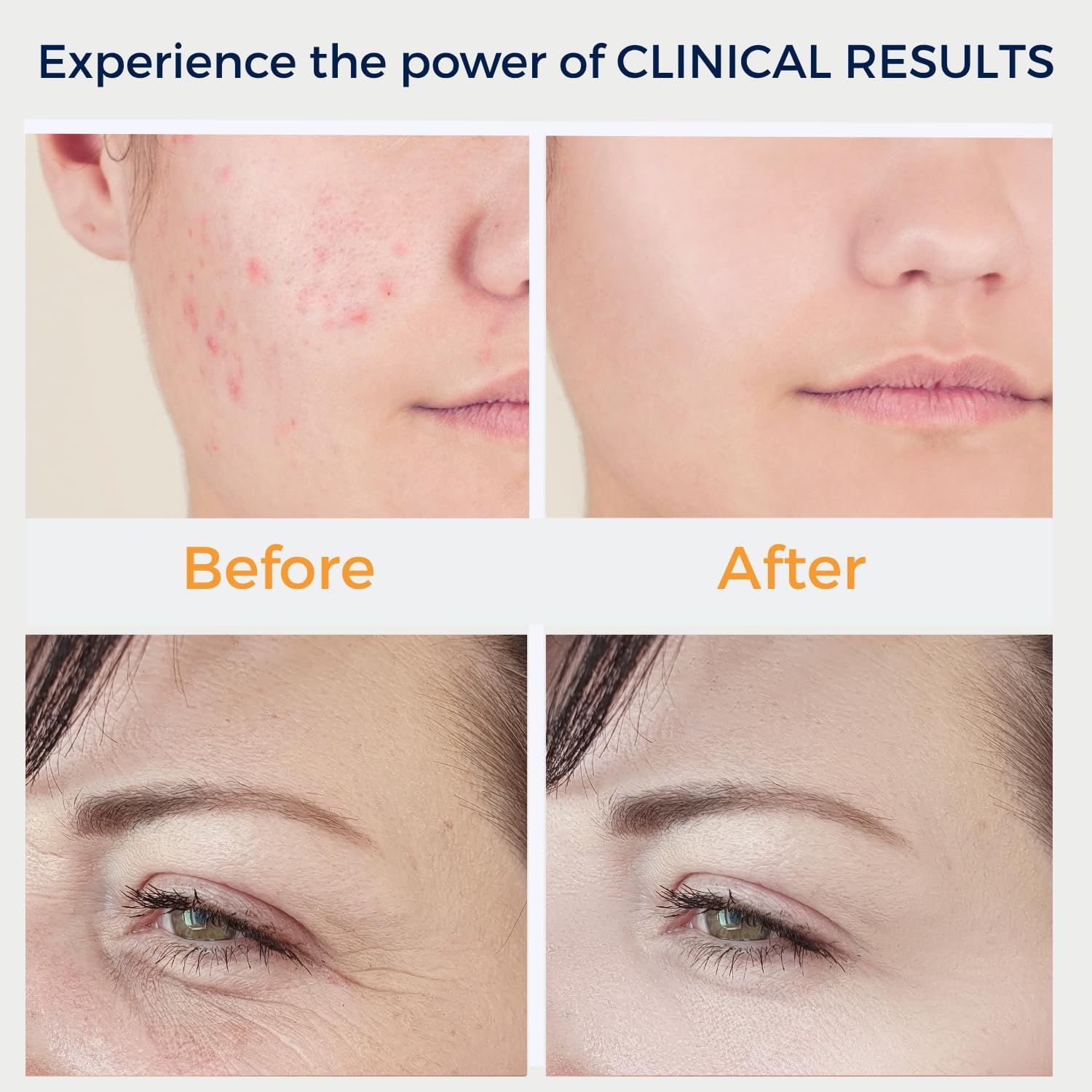 Handheld skin care stick (neon light style)